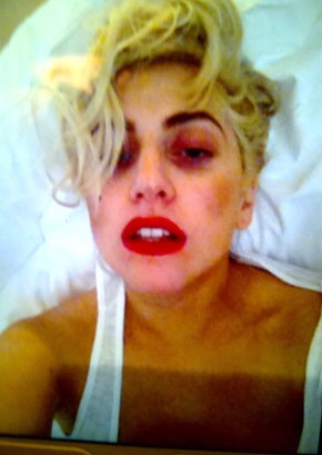 Gaga si z Nového Zélandu přivezla monokl